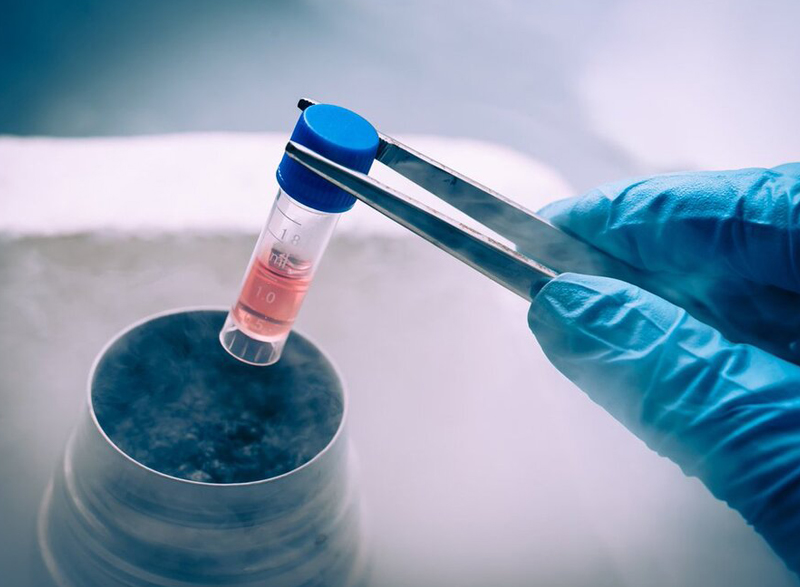 Fertility Preservation