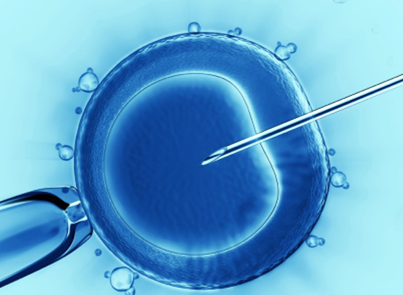 ICSI (Intracytoplasmic Sperm Injection)