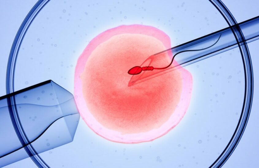 IVF (In Vitro Fertilization)